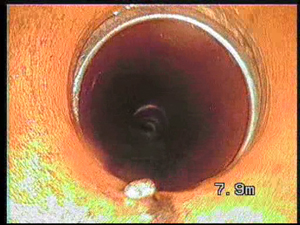 Tartre après curage